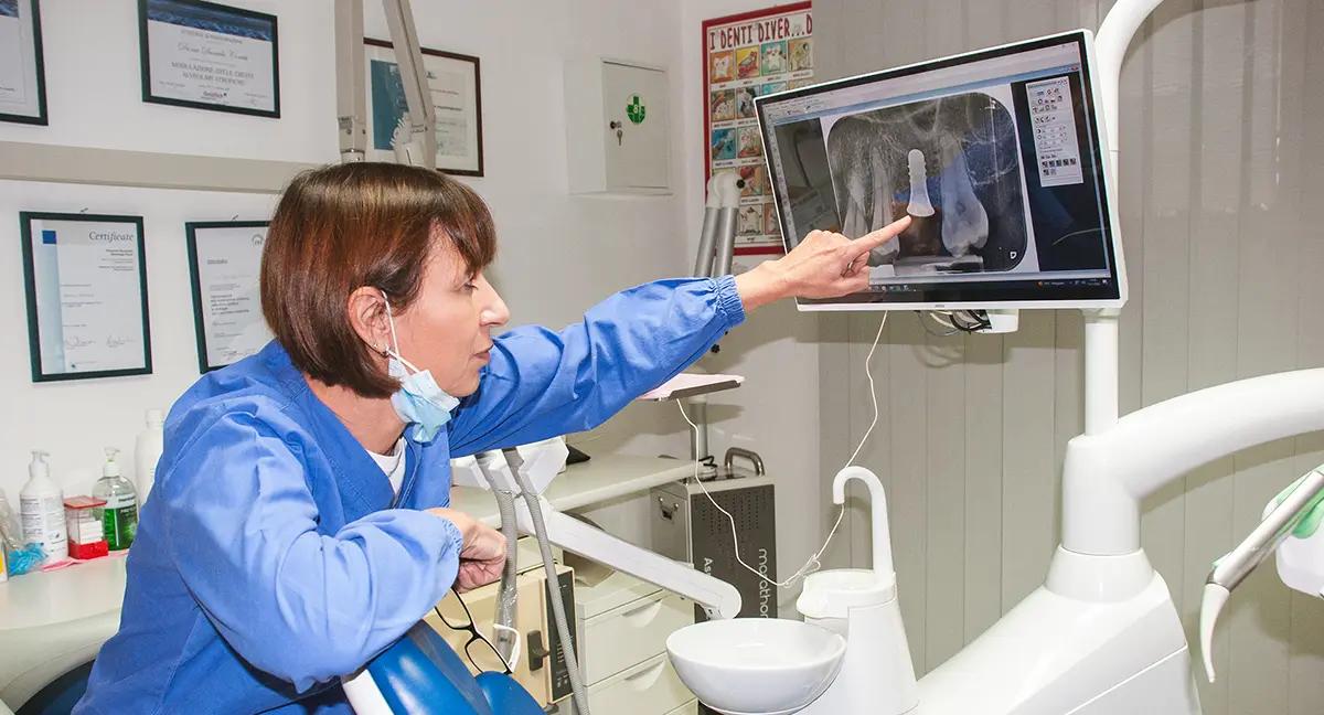 Come funziona l'impianto dentale nello Studio Odontoiatrico Dott.ssa Daniela Coretti