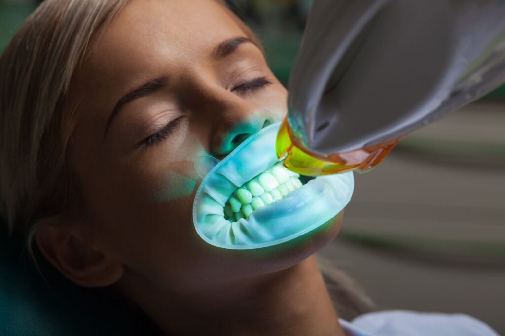 Studio Odontoiatrico Daniela Coretti - Sbiancamento dentale a Roma