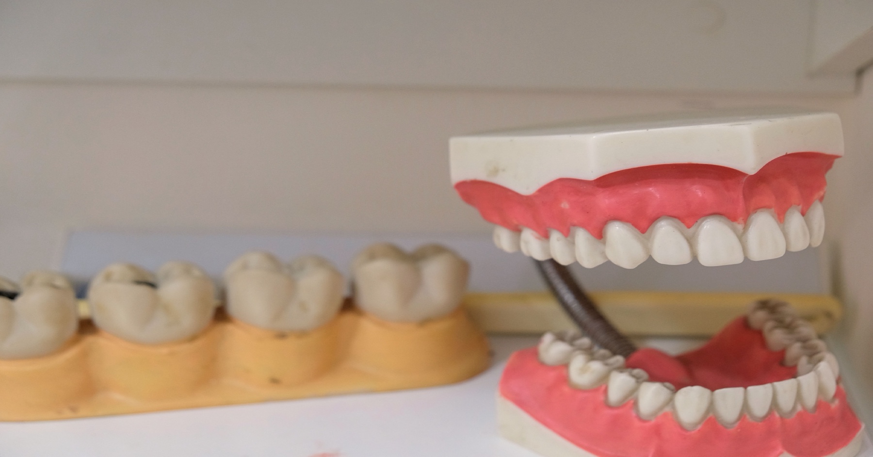 Modelli didattici di denti e gengive su un ripiano, foto illustrativa