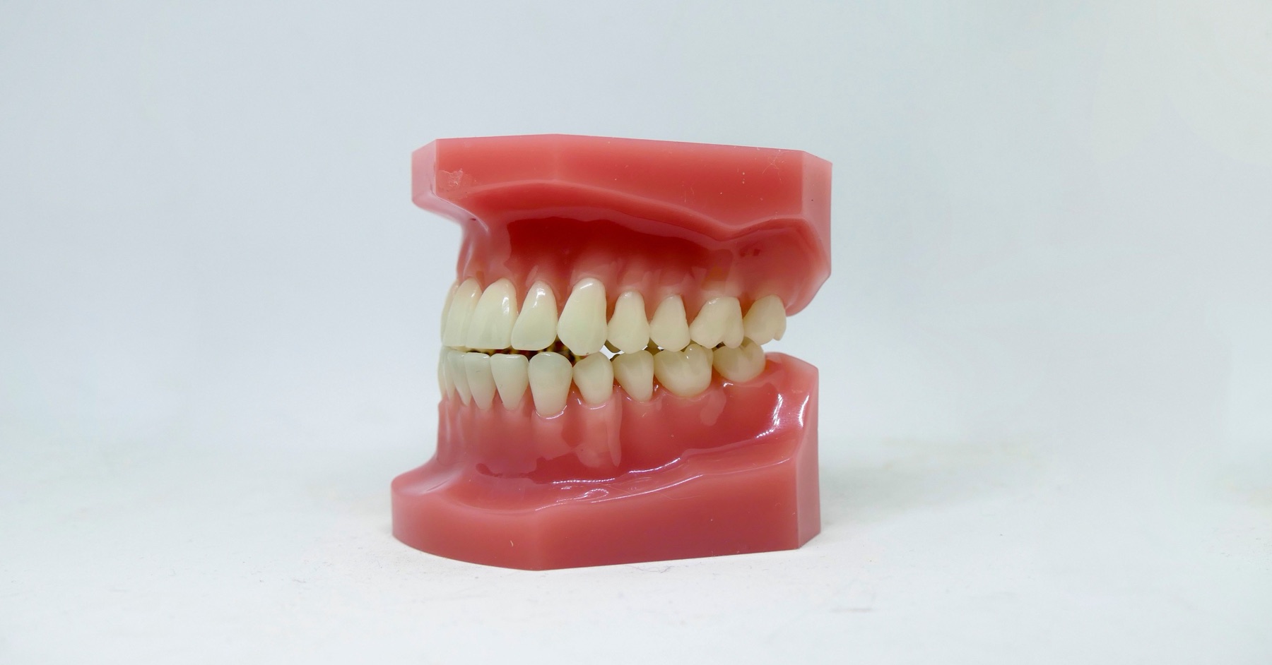 Modello didattico di arcate dentali con gengive in resina rosa, foto illustrativa